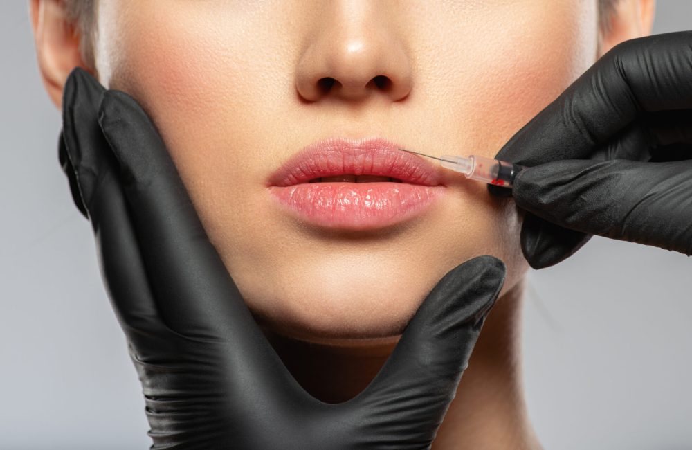 Young caucasian woman getting botox cosmetic injection in the lips. Beautiful woman gets botox injection in her face. Adult girl gets cosmetic injection of botox in a clinic. Beauty treatments